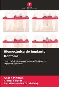 Produktbild: Biomec&acirc;nica do Implante Dent&aacute;rio