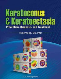 Produktbild: Wang, M:  Keratoconus and Keratoectasia