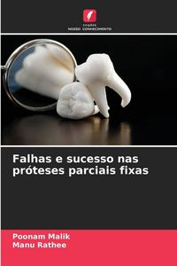 Produktbild: Falhas e sucesso nas pr&oacute;teses parciais fixas