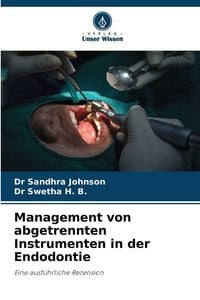 Produktbild: Management von abgetrennten Instrumenten in der Endodontie
