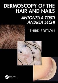 Produktbild: Dermoscopy of the Hair and Nails 3e