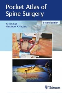 Produktbild: Pocket Atlas of Spine Surgery