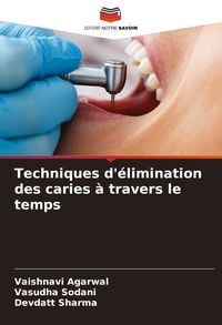 Produktbild: Techniques d'&eacute;limination des caries &agrave; travers le temps
