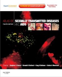 Produktbild: Atlas Of Sexually Transmitt-4e