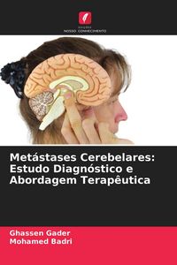 Produktbild: Met&aacute;stases Cerebelares: Estudo Diagn&oacute;stico e Abordagem Terap&ecirc;utica