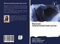 Produktbild: Visochno-nizhnechel&uuml;stnoj sustaw