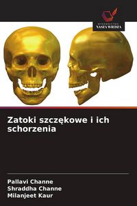 Produktbild: Zatoki szcz&iquest;kowe i ich schorzenia