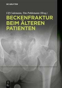 Produktbild: Beckenfraktur beim &auml;lteren Patienten