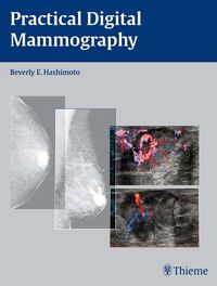 Produktbild: Practical Digital Mammography