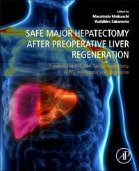 Produktbild: Safe Major Hepatectomy After Preoperative Liver Regeneration