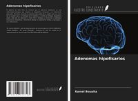 Produktbild: Adenomas hipofisarios