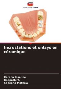 Produktbild: Incrustations et onlays en c&eacute;ramique