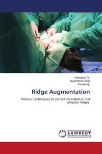 Produktbild: Ridge Augmentation
