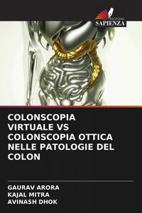 Produktbild: Colonscopia Virtuale Vs Colonscopia Ottica Nelle Patologie Del Colon