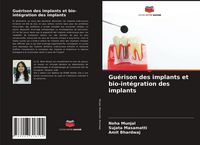 Produktbild: Gu&eacute;rison des implants et bio-int&eacute;gration des implants