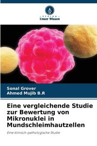 Produktbild: Eine vergleichende Studie zur Bewertung von Mikronuklei in Mundschleimhautzellen