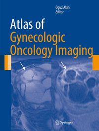 Produktbild: Atlas of Gynecologic Oncology Imaging