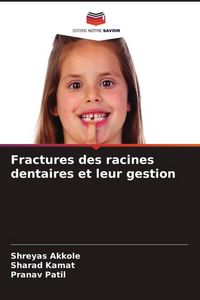 Produktbild: Fractures des racines dentaires et leur gestion
