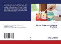 Produktbild: Recent Advances In Dental Implants