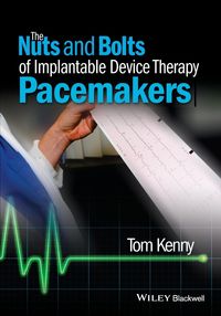 Produktbild: The Nuts and Bolts of Implantable Device Therapy
