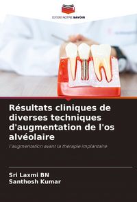 Produktbild: R&eacute;sultats cliniques de diverses techniques d'augmentation de l'os alv&eacute;olaire