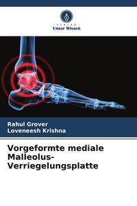 Produktbild: Vorgeformte mediale Malleolus-Verriegelungsplatte