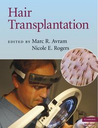 Produktbild: Hair Transplantation