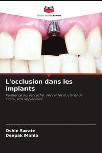 Produktbild: L'occlusion dans les implants