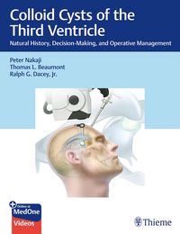 Produktbild: Colloid Cysts of the Third Ventricle