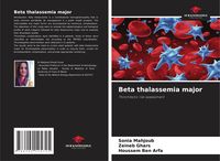 Produktbild: Beta thalassemia major