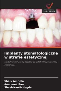 Produktbild: Implanty stomatologiczne w strefie estetycznej