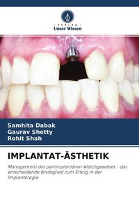 Produktbild: Implantat-&Auml;sthetik
