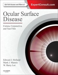 Produktbild: Ocular Surface Disease: Cornea, Conjunctiva and Tear Film E-Book