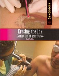Produktbild: Erasing the Ink: Getting Rid of Your Tattoo