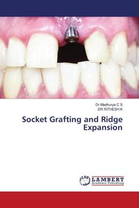 Produktbild: Socket Grafting and Ridge Expansion