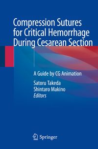 Produktbild: Compression Sutures for Critical Hemorrhage During Cesarean Section