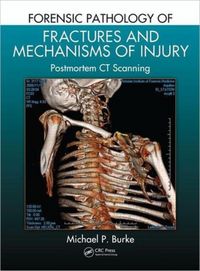 Produktbild: Burke, M: Forensic Pathology of Fractures and Mechanisms of