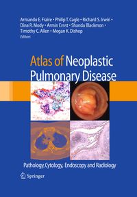 Produktbild: Atlas of Neoplastic Pulmonary Disease