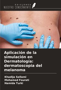Produktbild: Aplicaci&oacute;n de la simulaci&oacute;n en Dermatolog&iacute;a: dermatoscopia del melanoma