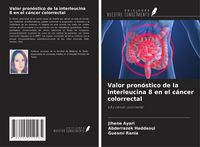 Produktbild: Valor pron&oacute;stico de la interleucina 8 en el c&aacute;ncer colorrectal