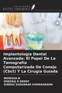 Produktbild: Implantolog&iacute;a Dental Avanzada: El Papel De La Tomograf&iacute;a Computarizada De Conejo (Cbct) Y La Cirug&iacute;a Guiada