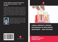 Produktbild: Carga Imediata Versus Retardada De Implantes Dent&aacute;rios - Uma Revis&atilde;o