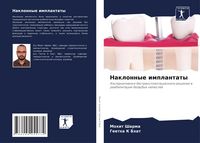Produktbild: Naklonnye implantaty