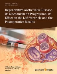 Produktbild: Degenerative Aortic Valve Disease, its Mechanism on Progression, its Effect on the Left Ventricle and the Postoperative Results