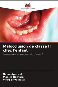 Produktbild: Malocclusion de classe II chez l'enfant