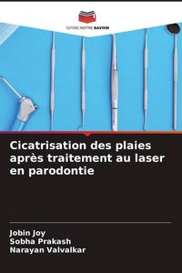 Produktbild: Cicatrisation des plaies apr&egrave;s traitement au laser en parodontie