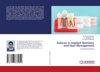 Produktbild: Failures in Implant Dentistry and their Management