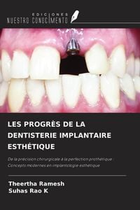 Produktbild: Les Progr&egrave;s De La Dentisterie Implantaire Esth&eacute;tique