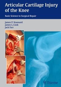 Produktbild: Articular Cartilage Injury of the Knee: Basic Science to Surgical Repair