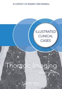 Produktbild: Thoracic Imaging